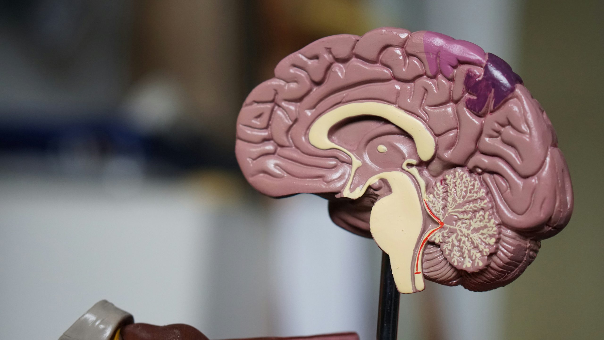 alzheimer tedavisi mumkun mu scaled