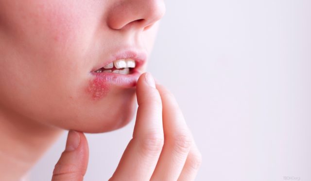 ucuk-alzheimermi-yapıyor