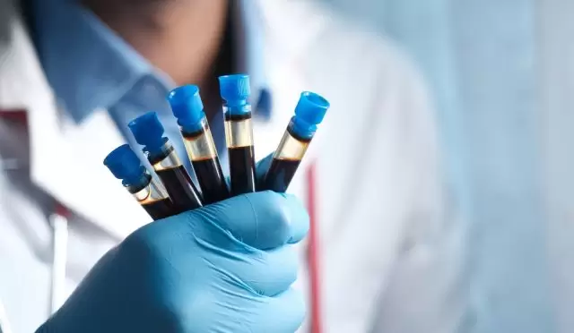 Erken Kanser Teşhisinde Devrim: Tümör DNA’sı Kan Testiyle Mümkün