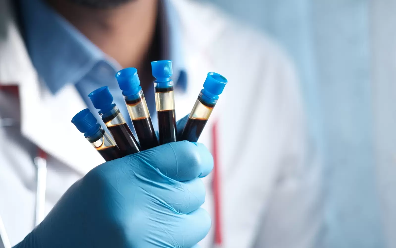 Erken Kanser Teşhisinde Devrim: Tümör DNA’sı Kan Testiyle Mümkün