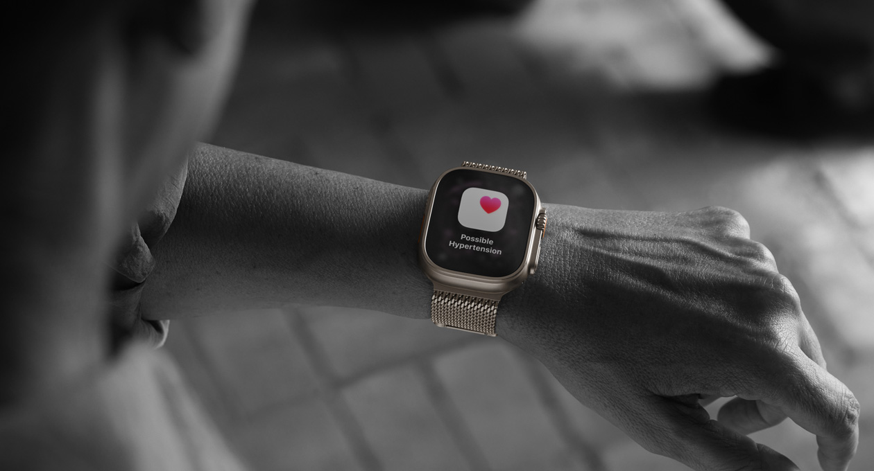 apple watch ultra 3 2