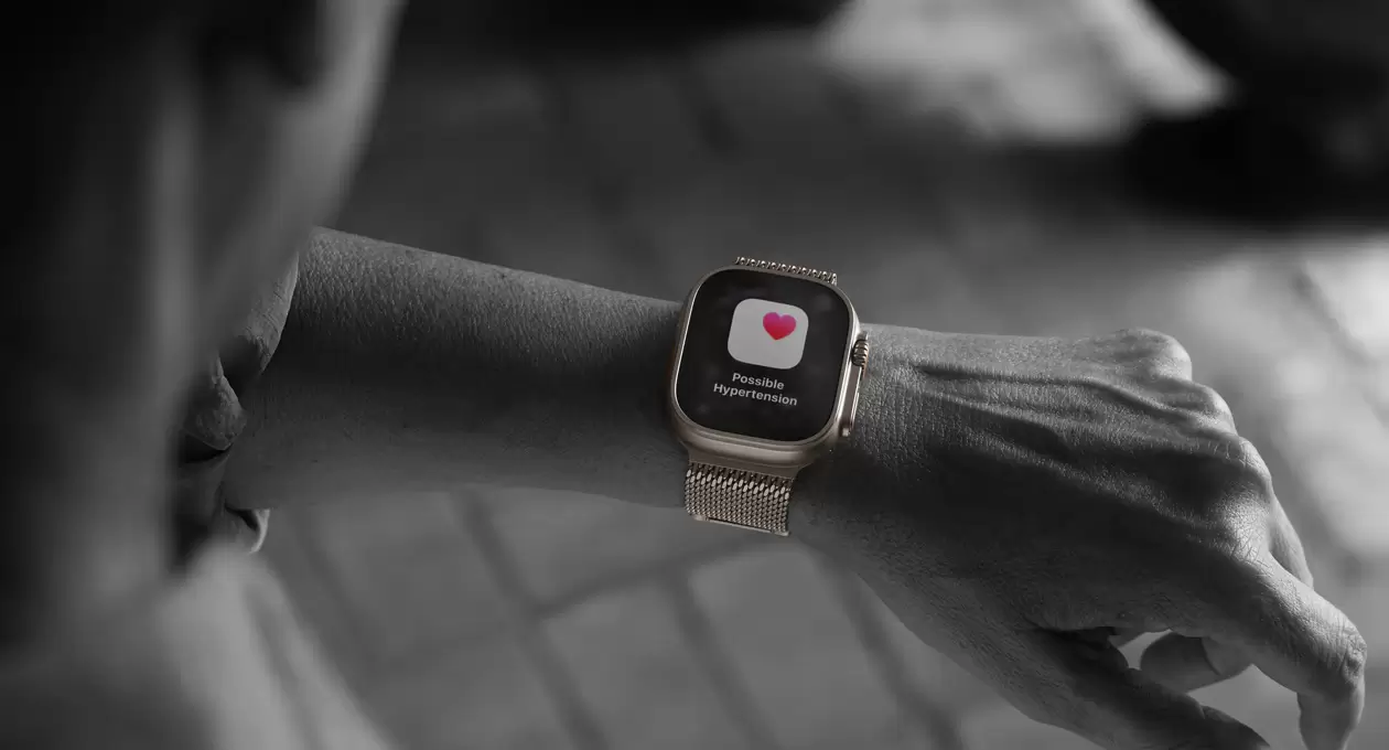 apple watch ultra 3 2